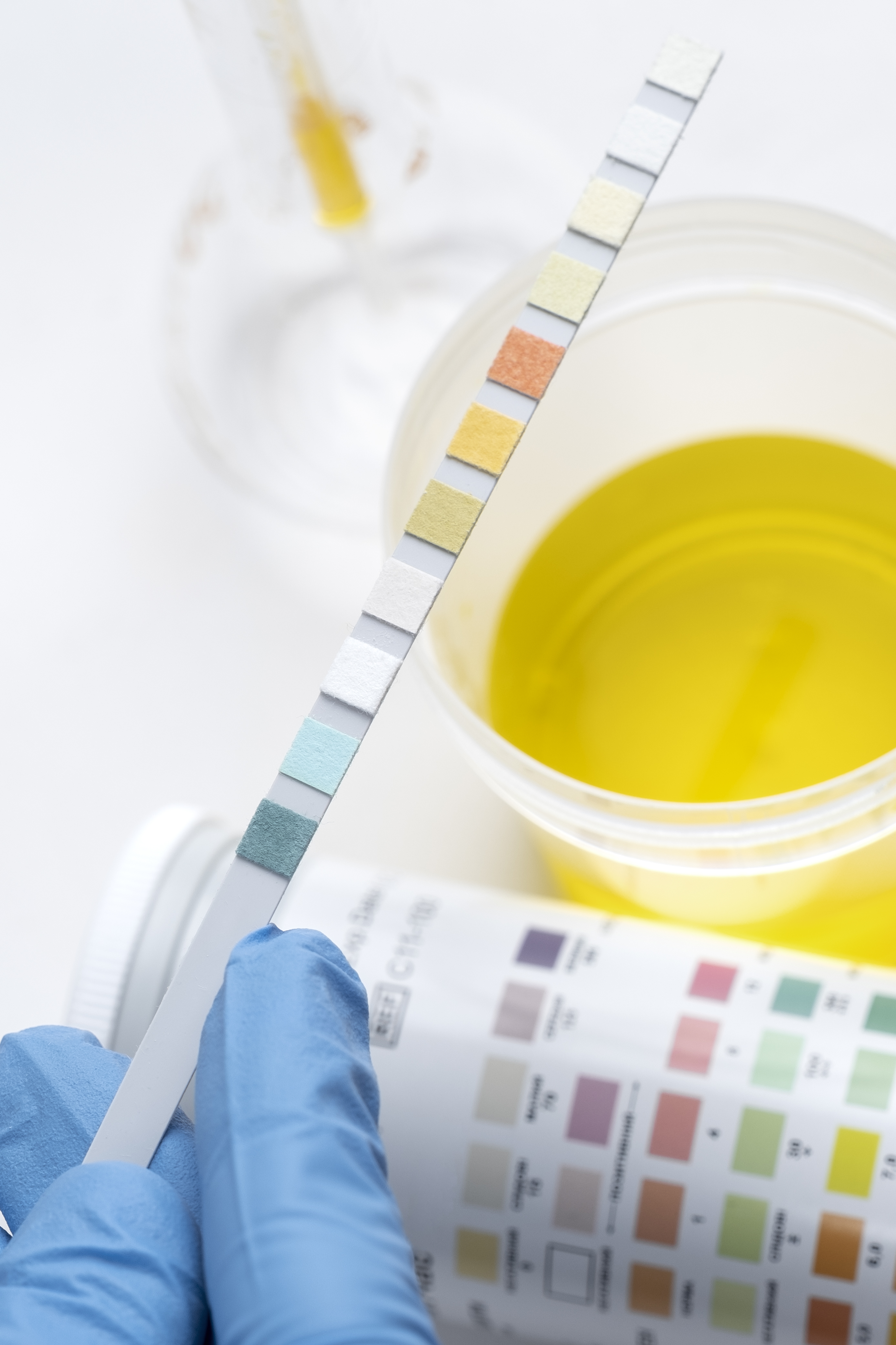 urine_testing